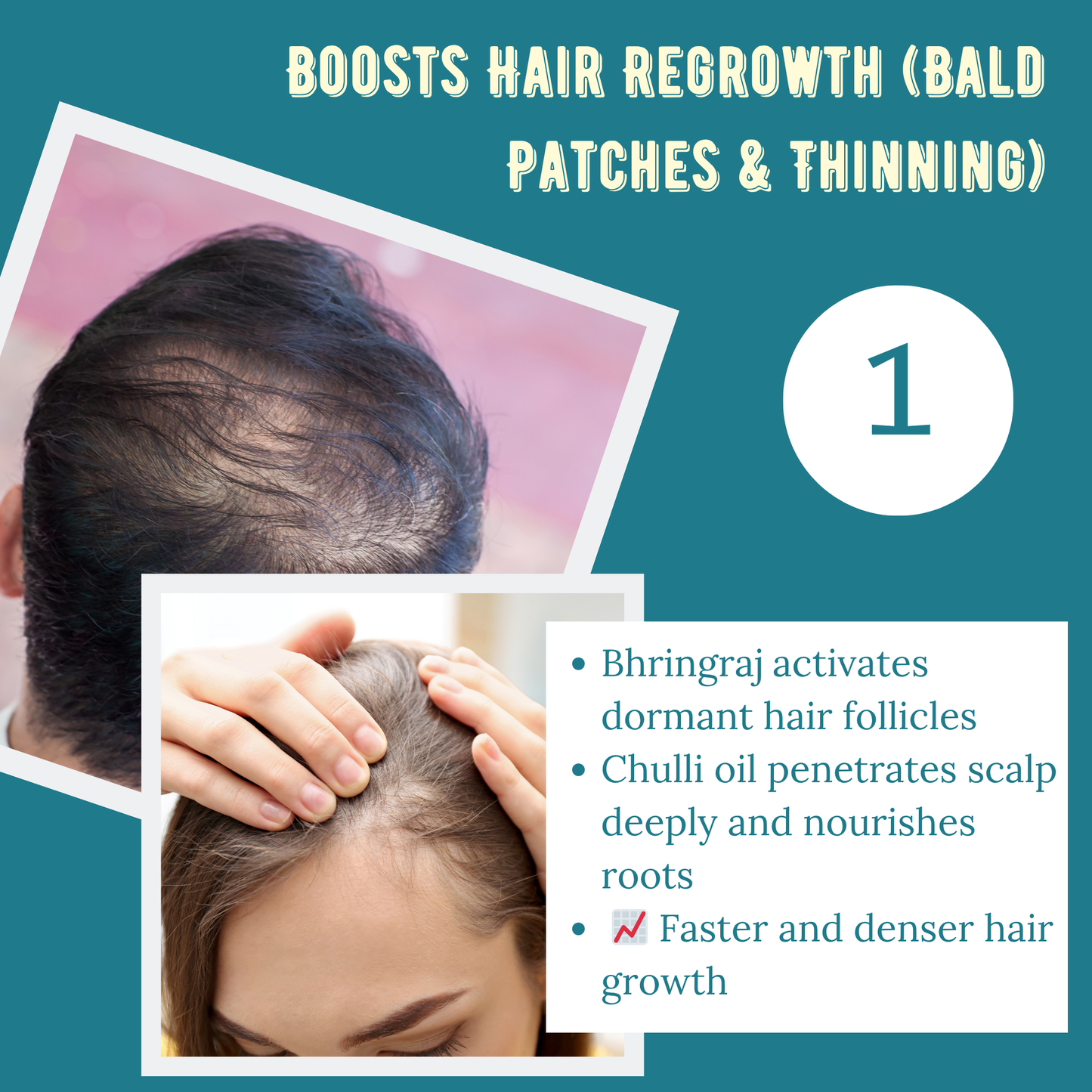 Joacare® Pahadi Chulli Oil – 5000-Year-Old Kinnauri Remedy for Hair Regrowth ( BUY 1 GET 1 FREE)