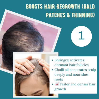 Joacare® Pahadi Chulli Oil – 5000-Year-Old Kinnauri Remedy for Hair Regrowth ( BUY 1 GET 1 FREE)
