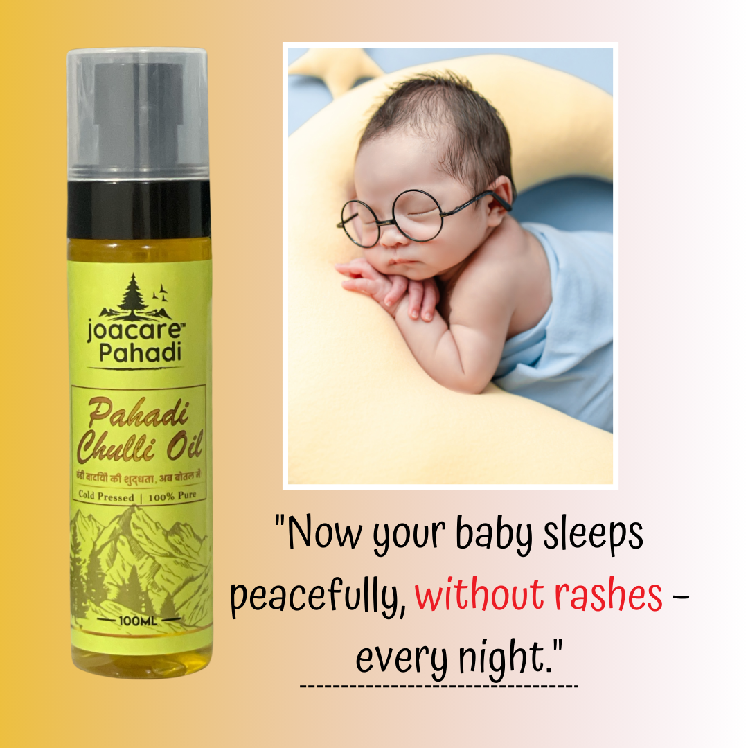 Pahadi Baby Skin & Rash Oil