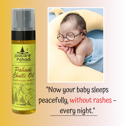 Pahadi Baby Skin & Rash Oil