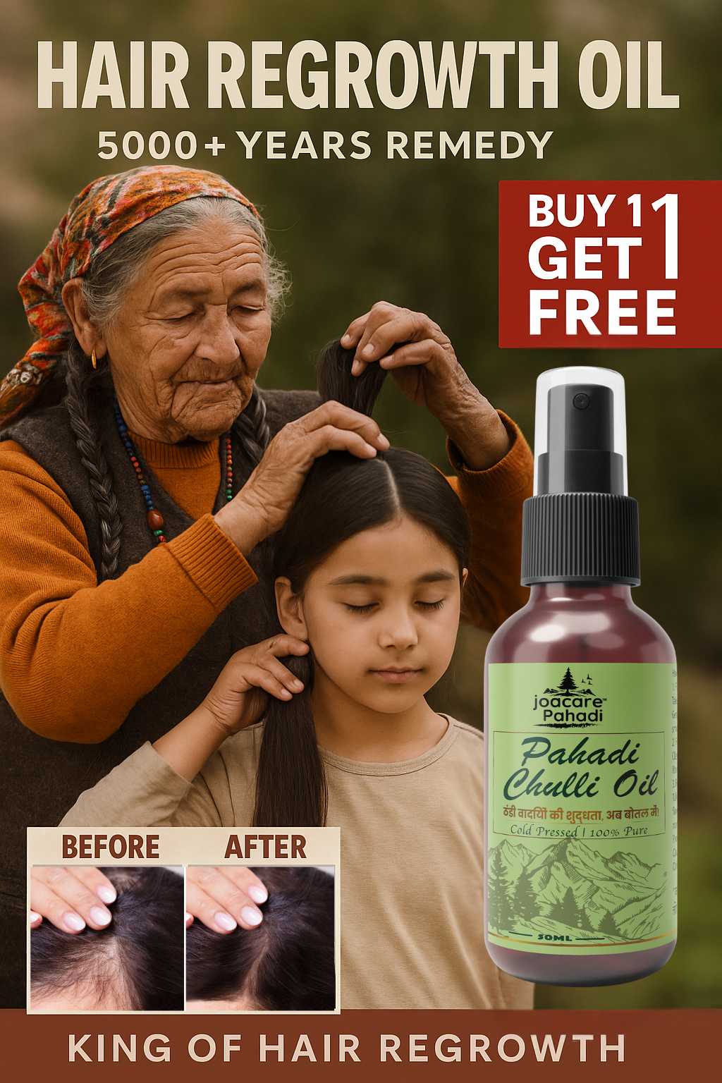 Joacare® Pahadi Chulli Oil – 5000-Year-Old Kinnauri Remedy for Hair Regrowth ( BUY 1 GET 1 FREE)