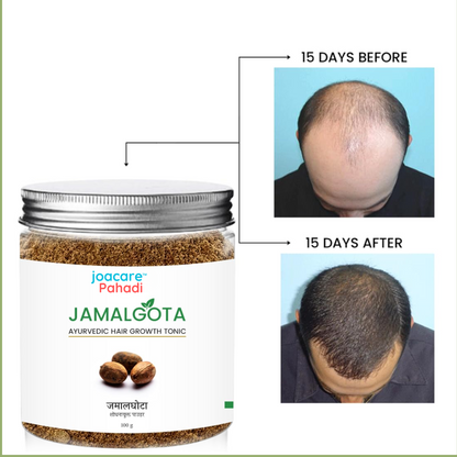 Jamalgota – Ayurvedic Powder for Hair Growth